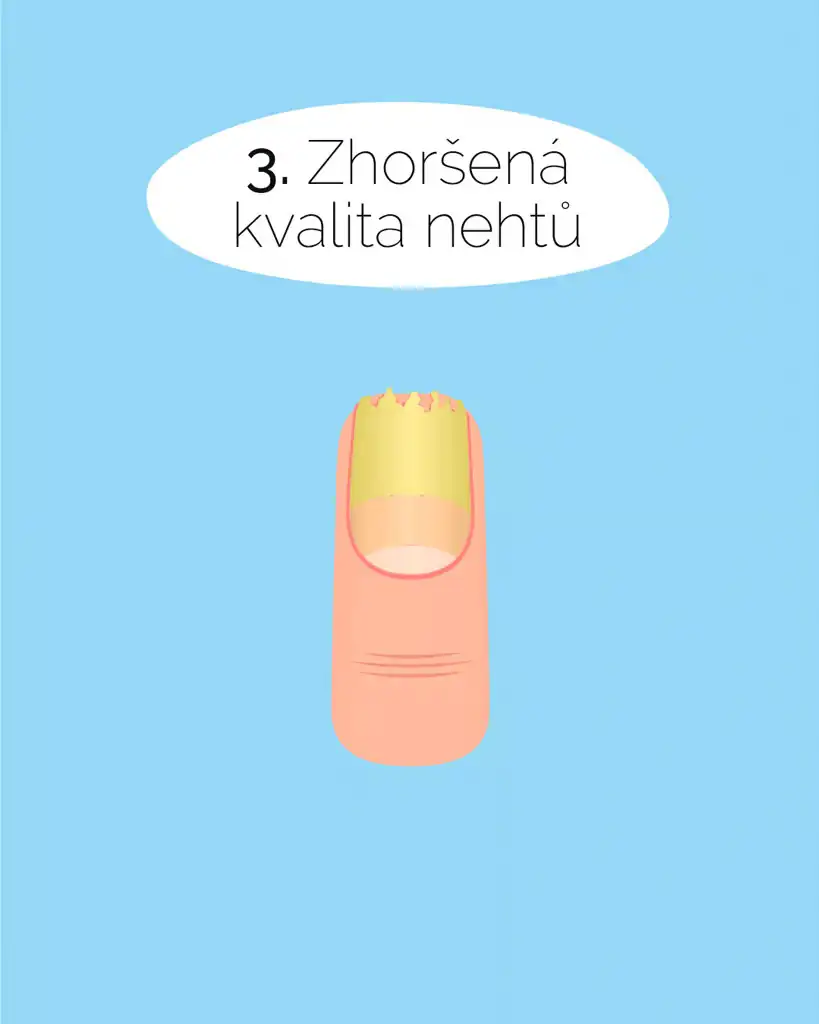 Zhoršená kvalita nehtů a nedostatek železa